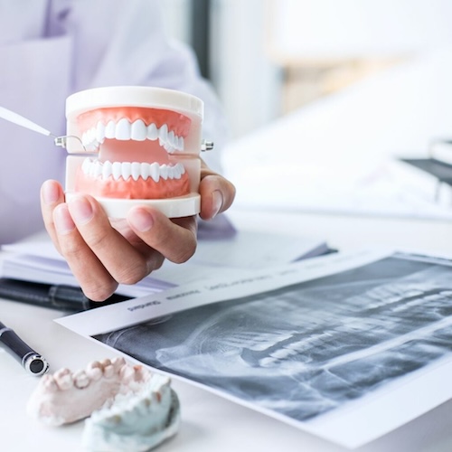 A dentist shows dentures